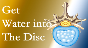 OrthoIllinois Chiropractic uses spinal manipulation and exercise to boost the diffusion of water into the disc which helps the health of the disc.