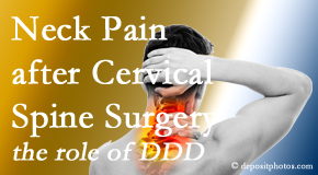 OrthoIllinois Chiropractic offers gentle treatment for neck pain after neck surgery.