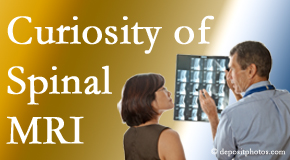 McHenry MRIs for spinal stenosis may be revealing…or confusing.