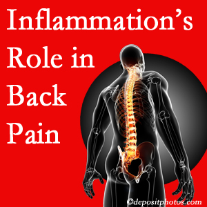 The role of inflammation in McHenry back pain is real. Chiropractic care can help.