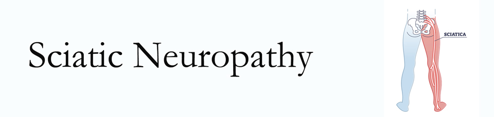 McHenry neuropathy pain (sciatica) 